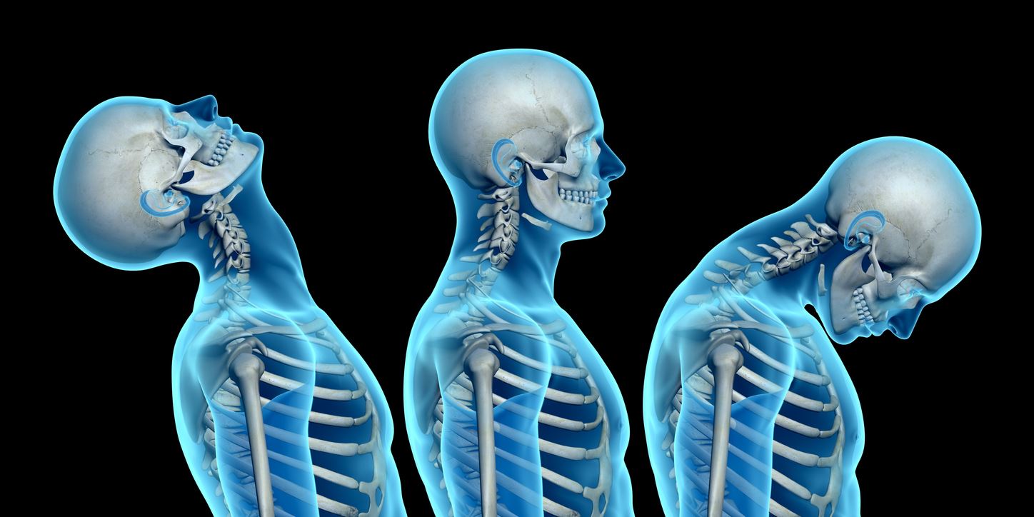 El Paso Criminal Defense Video How to prove your Whiplash Injury to